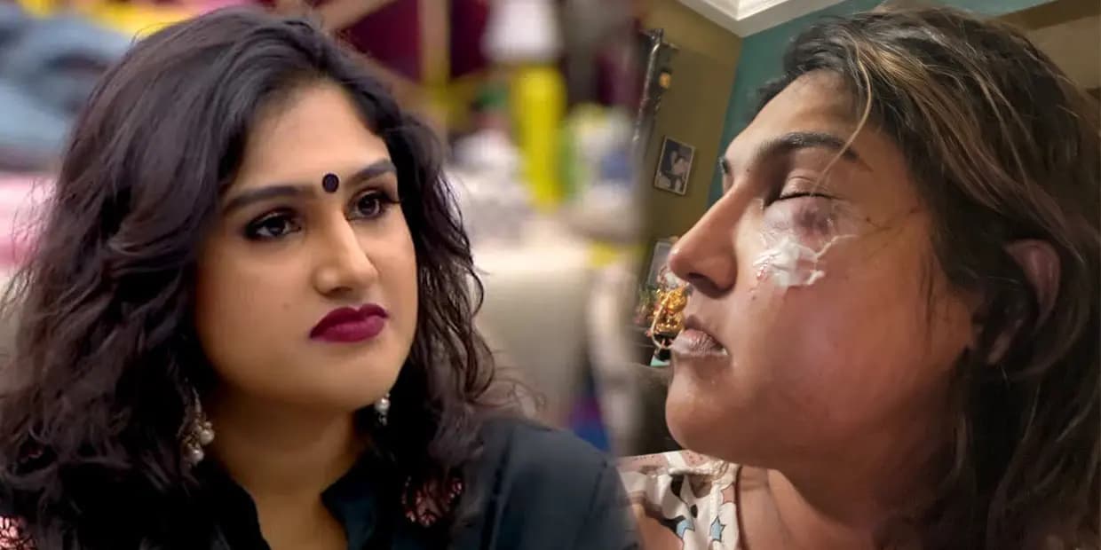 அத்தனையும் நாடகமா பேபி.? வனிதா மூஞ்ச ஒடச்சது யாரு.? சந்தேகத்தை கிளப்பிய 3 விஷயங்கள்