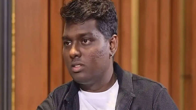 உருவ கேலி செய்த கோலிவுட் கோஷ்டி.. மூக்கை உடைத்து அனுப்பிய அட்லி