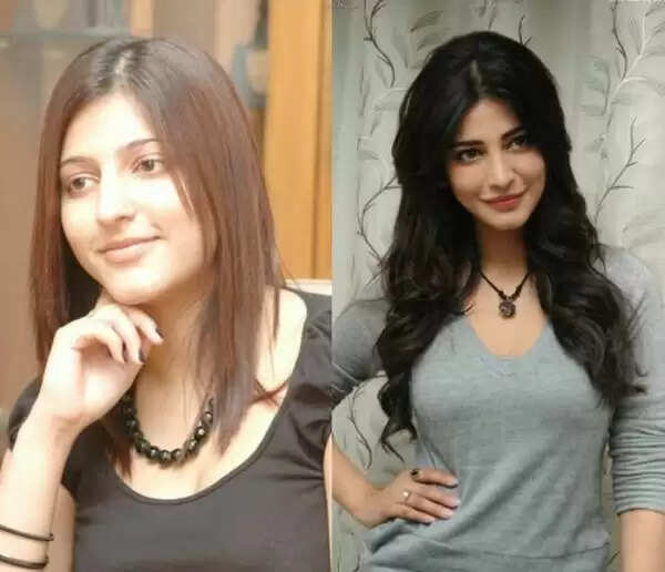 கூடுதல் கவர்ச்சிக்கு உதடு, இடுப்பை அறுவை சிகிச்சை செய்த 9 நடிகைகள்.. நயன்தாரா முதல் சமந்தா வரை