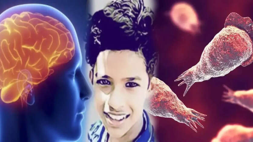 மூளையை தின்னும் அமீபாவால் 14 வயது சிறுவன் மரணம்.. கேரளாவில் ஏற்பட்ட அதிர்ச்சி சம்பவம்